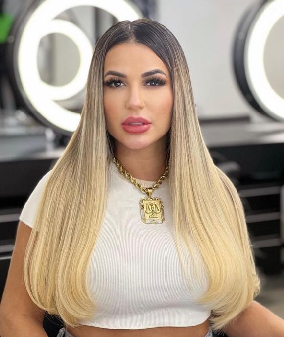 Além das lentes, Deolane Bezerra também realizou preenchimentos no seu rosto