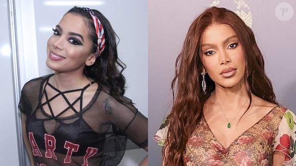 Anitta já realizou muitos procedimentos e plásticas, e um deles foi um preenchimento labial que deu o que falar na web