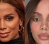 Rosto novo? Nem tudo é só bisturi! Especialista explica o que pode estar por trás da beleza renovada de Anitta, Emma Stone e mais famosas