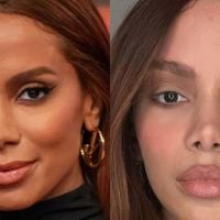 Rosto novo? Nem tudo é só bisturi! Especialista explica o que pode estar por trás da beleza renovada de Anitta, Emma Stone e mais famosas