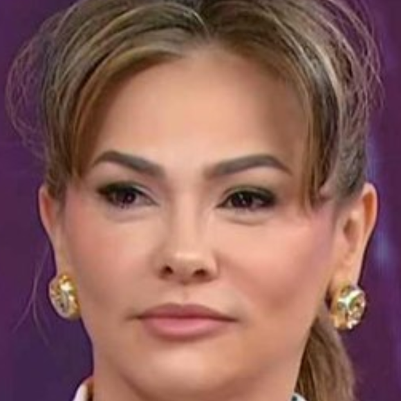 Ex-Tiazinha, Suzana Alves diz que topou harmonização facial na TV por dificuldades financeiras: ‘A situação aqui tá bem difícil’