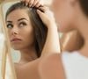O aumento da caspa no cabelo é notado por muitas mulheres no verão