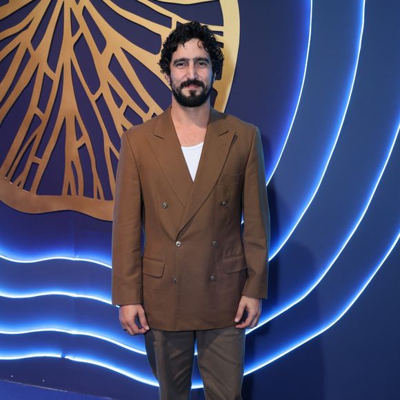 Renato Góes tem vitiligo: a doença de pele é caracterizada pela perda de pigmentação na região