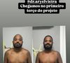 Antes e depois de Arlindinho impressiona: veja a foto publicada pelo sambista