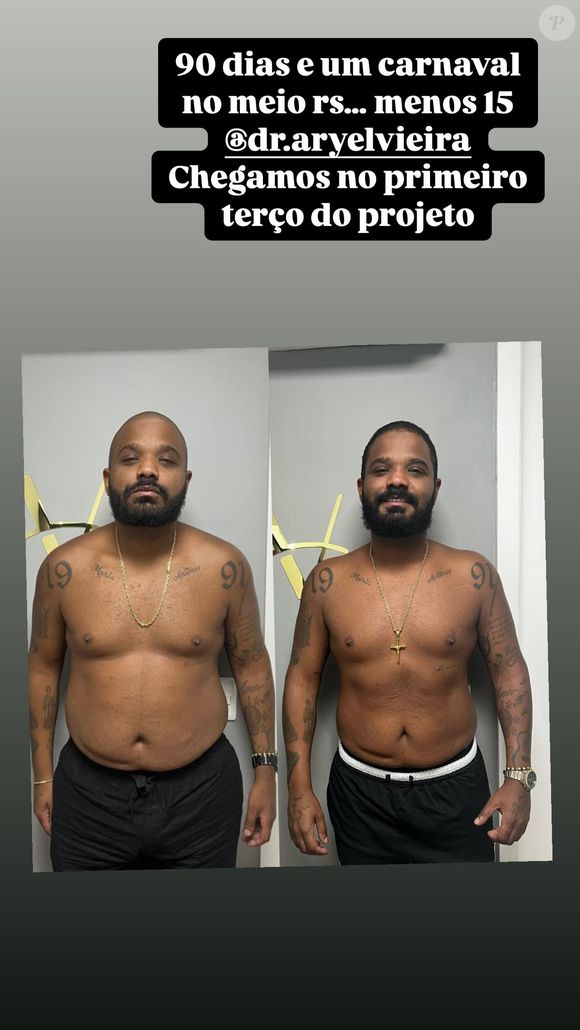 Antes e depois de Arlindinho impressiona: veja a foto publicada pelo sambista