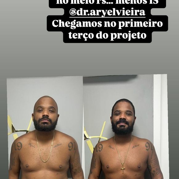 Antes e depois de Arlindinho impressiona: veja a foto publicada pelo sambista
