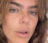 Mariana Goldfarb explica que seu melasma emocional resvala no hormonal, aparecendo de forma mais forte na pele