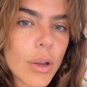 Mariana Goldfarb explica que seu melasma emocional resvala no hormonal, aparecendo de forma mais forte na pele