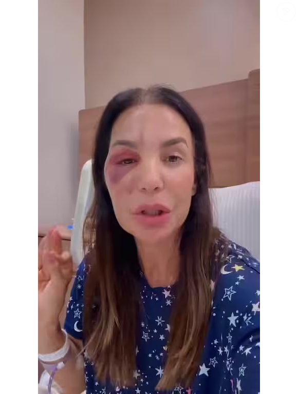 Ivete Sangalo passou, no início do mês, por uma cirurgia na face por conta do desmaio que sofreu no banheiro de casa