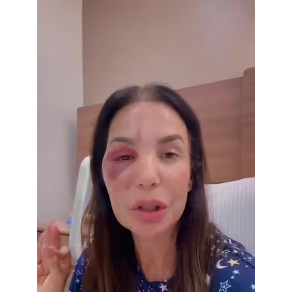 Ivete Sangalo passou, no início do mês, por uma cirurgia na face por conta do desmaio que sofreu no banheiro de casa