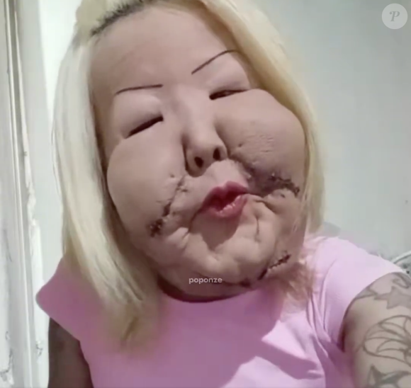 Depois de muitas críticas, Juju do Pix mostrou o resultado de sua cirurgia quase 2 meses após o procedimento
