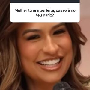 Simone Mendes ainda comentou sobre sua relação com o nariz antigo e disse que não gostava do formato