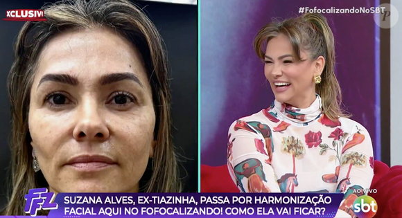 'Novo rosto' de Suzana Alves viralizou na internet e rendeu muitos elogios para a ex-Tiazinha