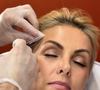 Ana Hickmann apostou no Xerf, uma nova tecnologia que estimula a produção e reorganização de colágeno para melhorar a firmeza da pele