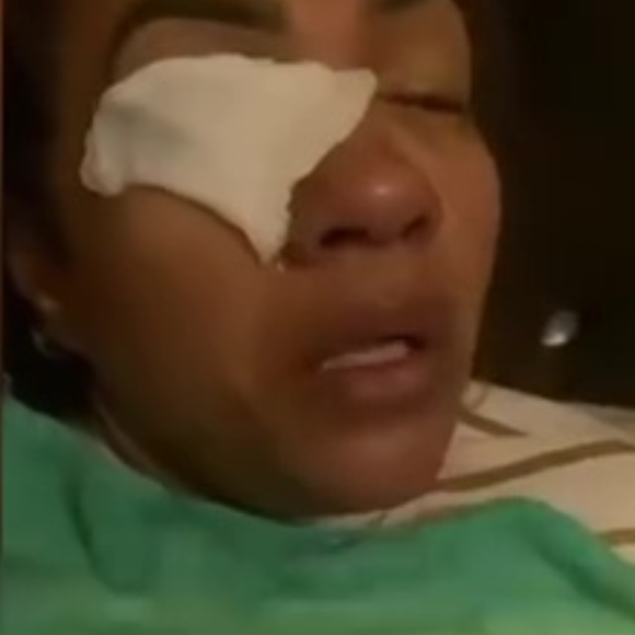 A cabeleireira Lidiane Herculano afirma que teve as córneas queimadas após usar um fortalecedor de cílios da marca