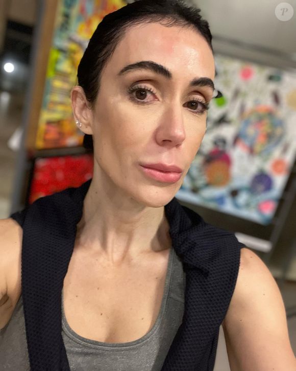 Sentindo a falta de colágeno da idade, Michelle Barros passou a fazer preenchimentos