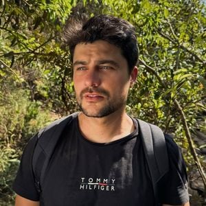 Tipo de harmonização facial feita por Guilherme Leicam visa a simetria geral do rosto, promovendo preenchimentos em toda sua área