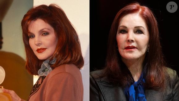 Antes e depois de Priscilla Presley: vítima de um falso cirurgião que implantava silicone industrial em clientes, o ícone de beleza quase ficou com o rosto deformado