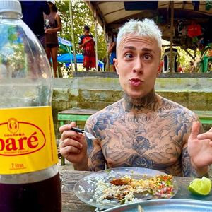 Depois de diversas críticas, MC Daniel fez harmonização facial