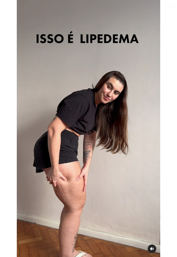 No vídeo original, Tânia Carvalho conversa e conscientiza o público sobre o lipedema, sem citar chá em nenhum momento
