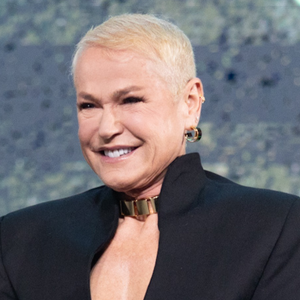 Microscópio 3D, lâminas de safira e mais: prepare-se para se surpreender com a inovadora técnica de transplante capilar de Xuxa