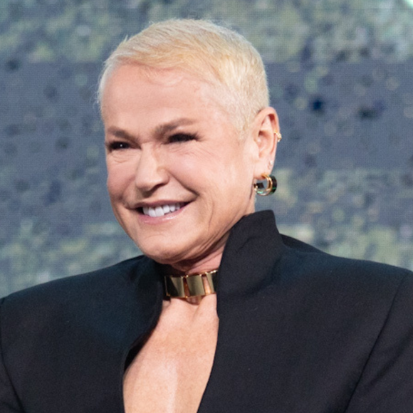 Microscópio 3D, lâminas de safira e mais: prepare-se para se surpreender com a inovadora técnica de transplante capilar de Xuxa