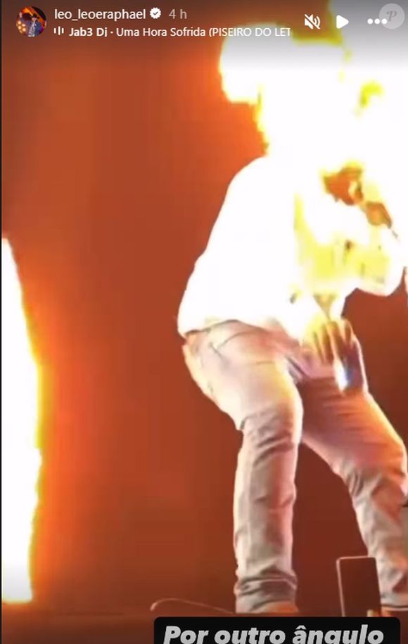 As imagens do rosto de Léo pegando fogo impressionam