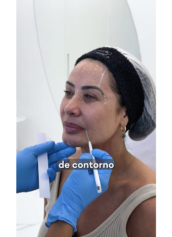 Scheila Carvalho também passou a apostar em técnicas de beleza pouco invasivas, como lasers