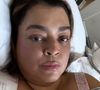 Preta Gil retirou tumores na cirurgia