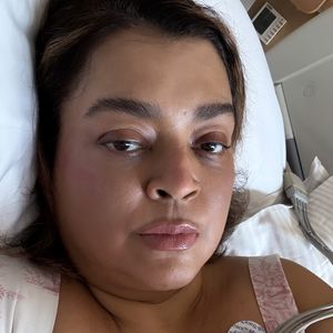 Preta Gil retirou tumores na cirurgia