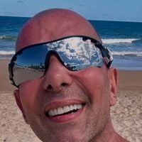 'Mais de 12 mil fios de cabelo': médico explica transplante capilar de Rafael Ilha, diagnosticado com calvície avançada em grau 7