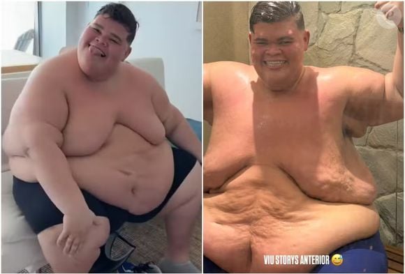 Transformação radical de Gordão da XJ deixou internautas de queixo caído; veja a diferença!