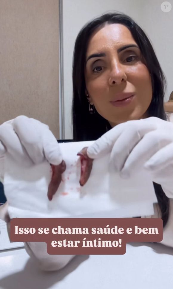 Fotos da cirurgia íntima de Lica Lopes até mostravam pedaços de pele retirados de uma vagina