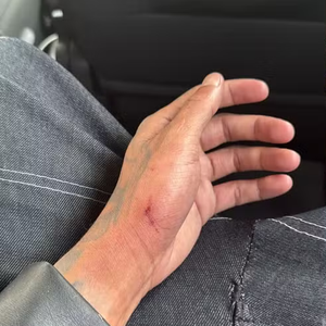 Gato Preto apareceu na web após o acidente com a mão machucada. Ele chegou a reclamar do prejuízo financeiro: ‘Um milhão e meio jogado fora’