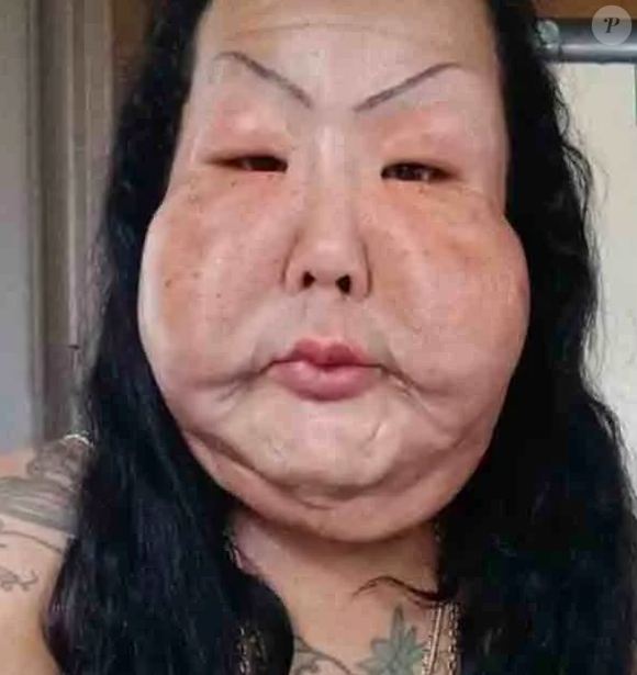 Juju do Pix ganhou esse apelido após ter injetado óleo mineral no rosto em clínica clandestina