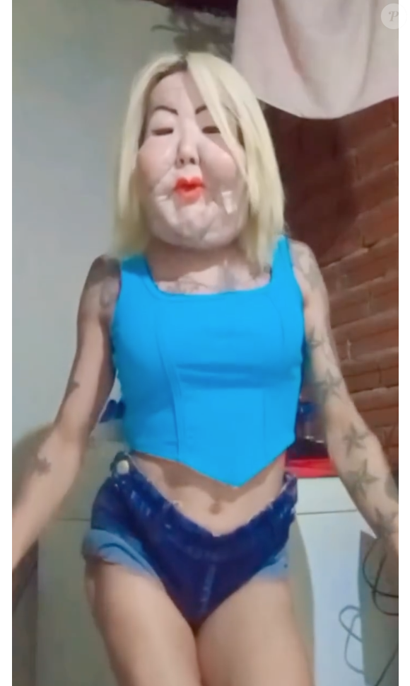 Com apenas um curativo pequeno, Juju do Pix garantiu que está ótima após a cirurgia