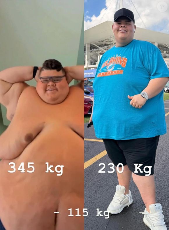 Gordão da XJ deixou a web de queixo caído ao mostrar o antes e depois do seu corpo ao perder 115 kg