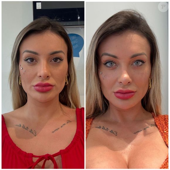 Andressa Urach fez uma cirurgia para mudar a cor dos olhos recentemente