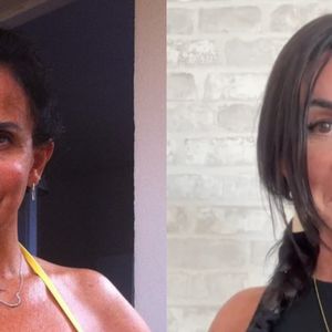 Antes e depois de Gretchen: dançarina sempre causa polêmica por seus procedimentos estéticos no rosto