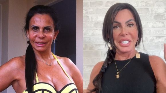 Antes e depois de Gretchen: dançarina sempre causa polêmica por seus procedimentos estéticos no rosto