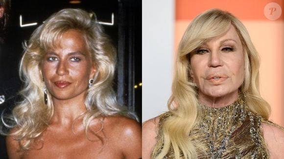 Antes e depois de Donatella Versace: estilista é uma das que mais choca com sua transformação ao longo dos anos