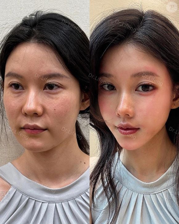 Dr. Lifeng é uma das principais referências quando o assunto é rejuvenescimento facial