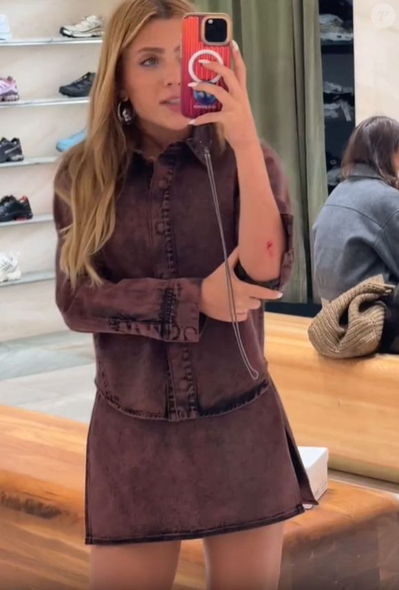 Jade Picon ficou com o corpo machucado após cair na rua