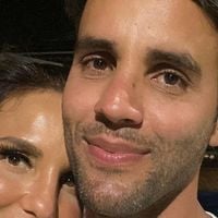 Ivete Sangalo é exaltada pelo ex-marido, Daniel Cady, após acidente em casa e cirurgia no rosto: 'Mulher de aço'