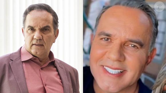 Antes e depois de Humberto Martins: galã da Globo mudou o rosto e suavizou rugas com uma harmonização feita no final de 2024