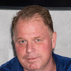 Irmão de Meghan Markle declarou que os médicos não deram outra opção: ‘Disseram-me que a perna tinha de ser amputada e que era uma questão de vida ou morte’