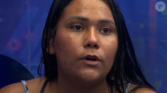 A participação de Chaiany Andrade no 'BBB 26' destacou a importância de falar abertamente sobre pele acneica e cuidados diários.