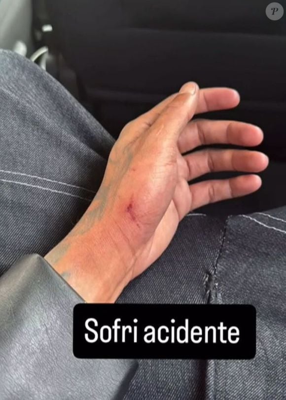 Gato Preto contou em sua rede social que tinha sofrido um acidente