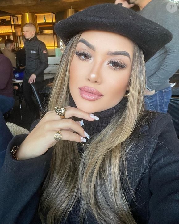 Harmonização facial de Jordana mudou bastante seus contornos