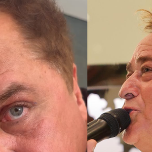 Antes e depois: Leonardo fez uma blefaroplastia